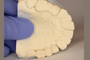 Body Part Name of Palate